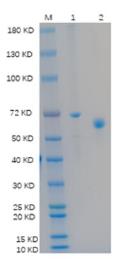 SDS-PAGE (GAD2-9169H).jpg